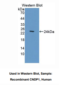 人肌肽酶1(CNDP1)多克隆抗体