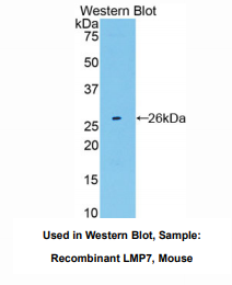 https://msimg.bioon.com/bionline/goods-no-pic.png