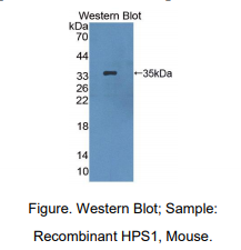 https://msimg.bioon.com/bionline/goods-no-pic.png