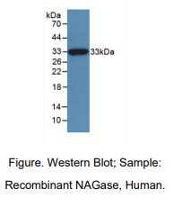 https://msimg.bioon.com/bionline/goods-no-pic.png