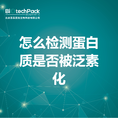 https://msimg.bioon.com/bionline/goods-no-pic.png