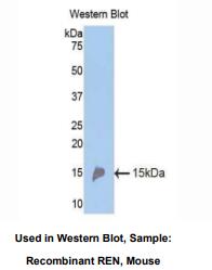 https://msimg.bioon.com/bionline/goods-no-pic.png