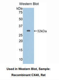 https://msimg.bioon.com/bionline/goods-no-pic.png