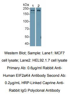 人真核翻译起始因子2α激酶4(EIF2aK4)多克隆抗体