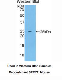 小鼠侧支发芽因子同源物2(SPRY2)多克隆抗体