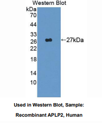 https://msimg.bioon.com/bionline/goods-no-pic.png