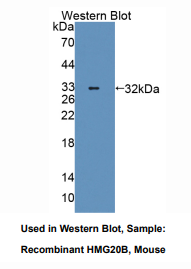 https://msimg.bioon.com/bionline/goods-no-pic.png