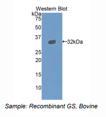 牛凝溶胶蛋白(GSN)多克隆抗体