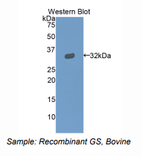 https://msimg.bioon.com/bionline/goods-no-pic.png