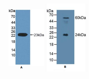 人肝配蛋白A1(EFNA1)多克隆抗体