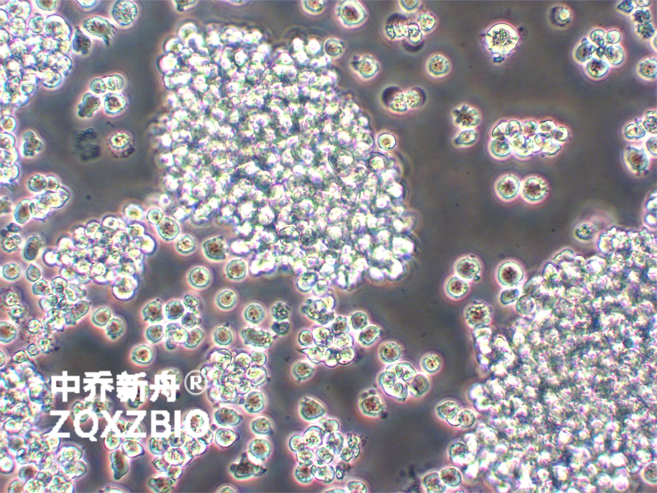 SUP-T1-GFP人T淋巴瘤细胞-绿色标记