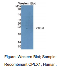 https://msimg.bioon.com/bionline/goods-no-pic.png