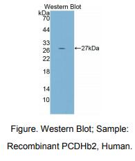 人原钙黏素β2(PCDHb2)多克隆抗体