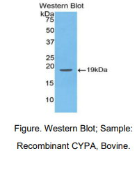 https://msimg.bioon.com/bionline/goods-no-pic.png