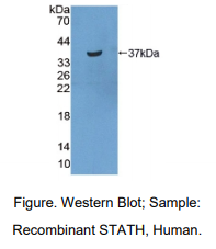 https://msimg.bioon.com/bionline/goods-no-pic.png