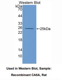 大鼠碳酸酐酶ⅤA(CA5A)多克隆抗体