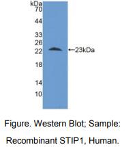 人应激诱导磷蛋白1(STIP1)多克隆抗体