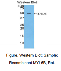 大鼠肌球蛋白轻链6B(MYL6B)多克隆抗体