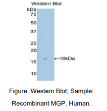 人基质Gla蛋白(MGP)多克隆抗体