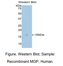 https://msimg.bioon.com/bionline/goods-no-pic.png