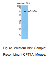 https://msimg.bioon.com/bionline/goods-no-pic.png