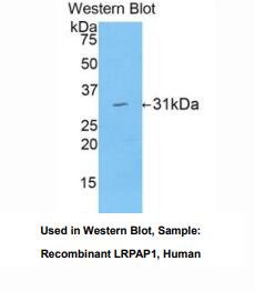 人低密度脂蛋白受体相关蛋白关联蛋白1(LRPAP1)多克隆抗体