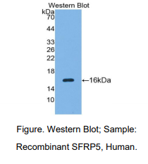人分泌型卷曲相关蛋白5(SFRP5)多克隆抗体