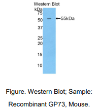 https://msimg.bioon.com/bionline/goods-no-pic.png