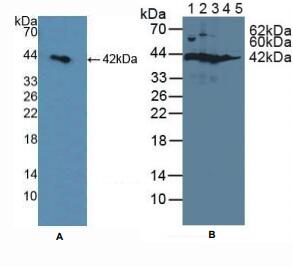 大鼠山梨醇脱氢酶(SDH)多克隆抗体