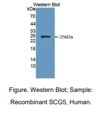 人分泌粒蛋白Ⅴ(SCG5)多克隆抗体