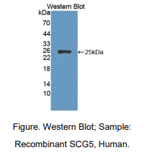 https://msimg.bioon.com/bionline/goods-no-pic.png