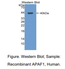 https://msimg.bioon.com/bionline/goods-no-pic.png