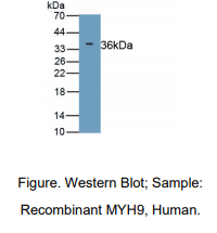 https://msimg.bioon.com/bionline/goods-no-pic.png