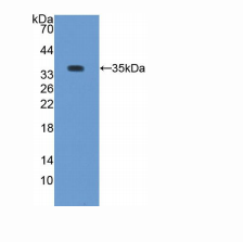 兔蛋白激酶Cβ1(PKCb1)多克隆抗体