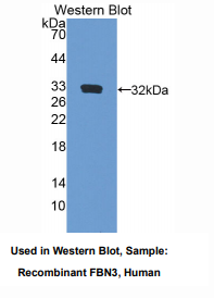 https://msimg.bioon.com/bionline/goods-no-pic.png