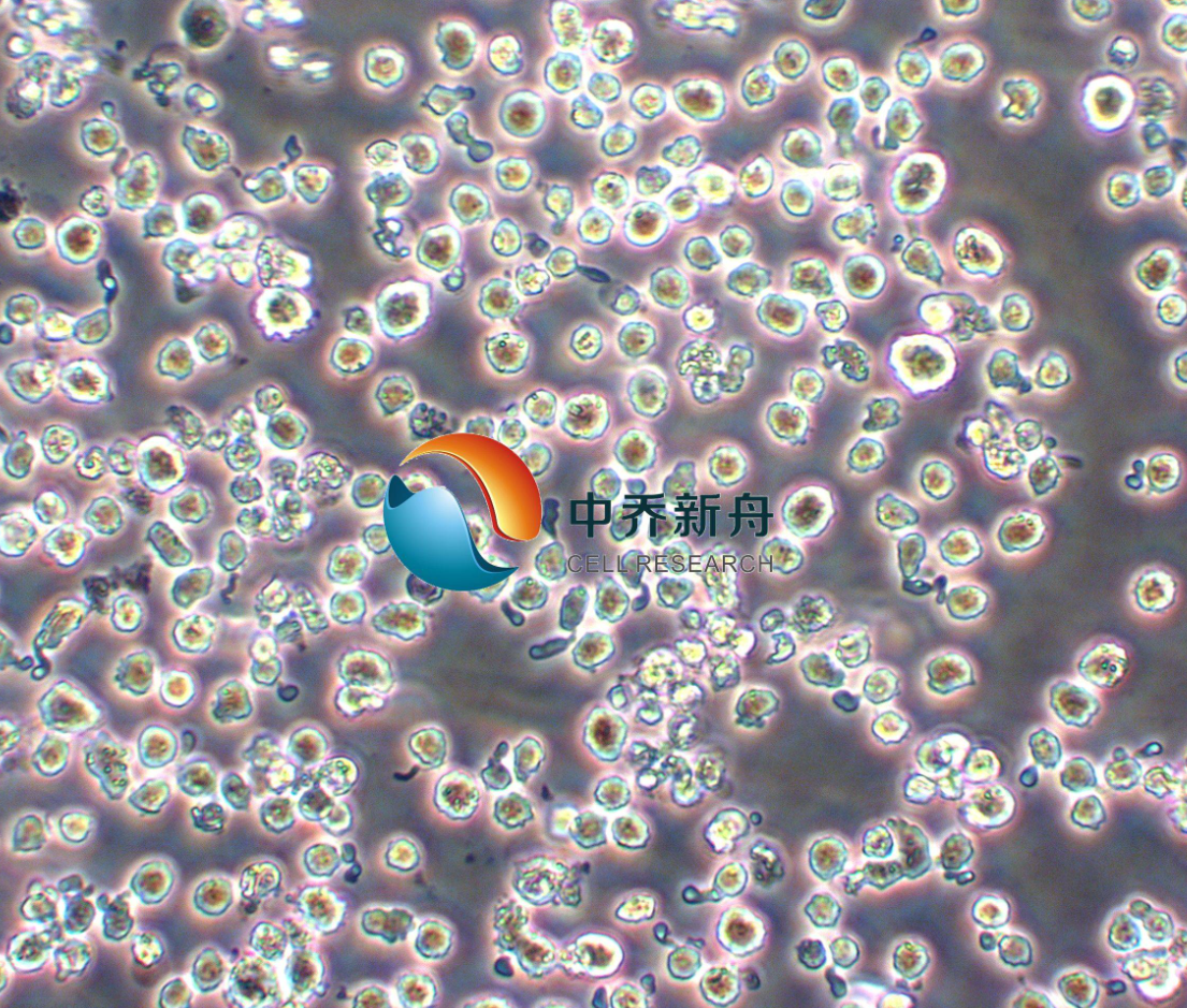 人多发性骨髓瘤细胞