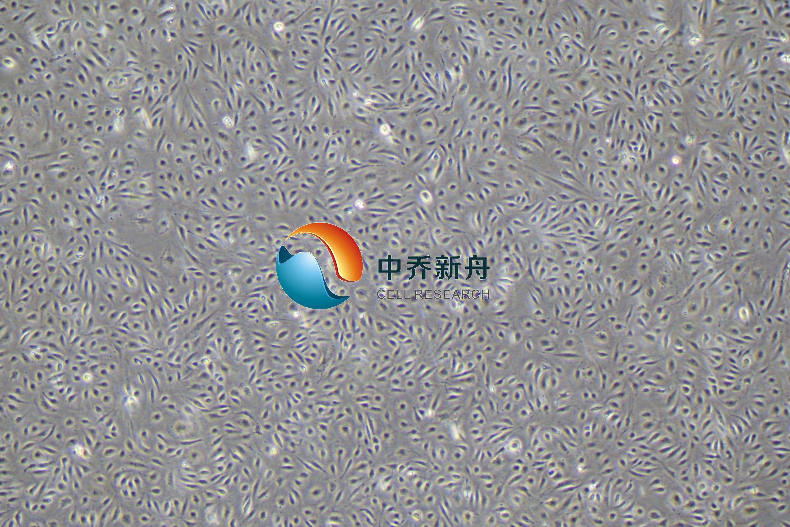 人真皮微血管内皮细胞永生化(成人)