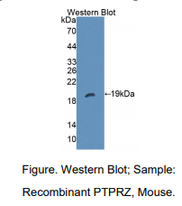 https://msimg.bioon.com/bionline/goods-no-pic.png