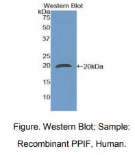 https://msimg.bioon.com/bionline/goods-no-pic.png