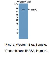 人血小板反应蛋白3(THBS3)多克隆抗体