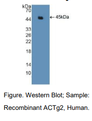 https://msimg.bioon.com/bionline/goods-no-pic.png