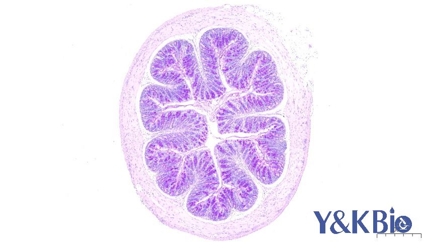 https://img.medsci.cn/09f7f9b396aaea8c5a2398de56f920980d508f8e7313325b130eae0a6c633bd4.png