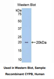 人亲环素B(CYPB)多克隆抗体