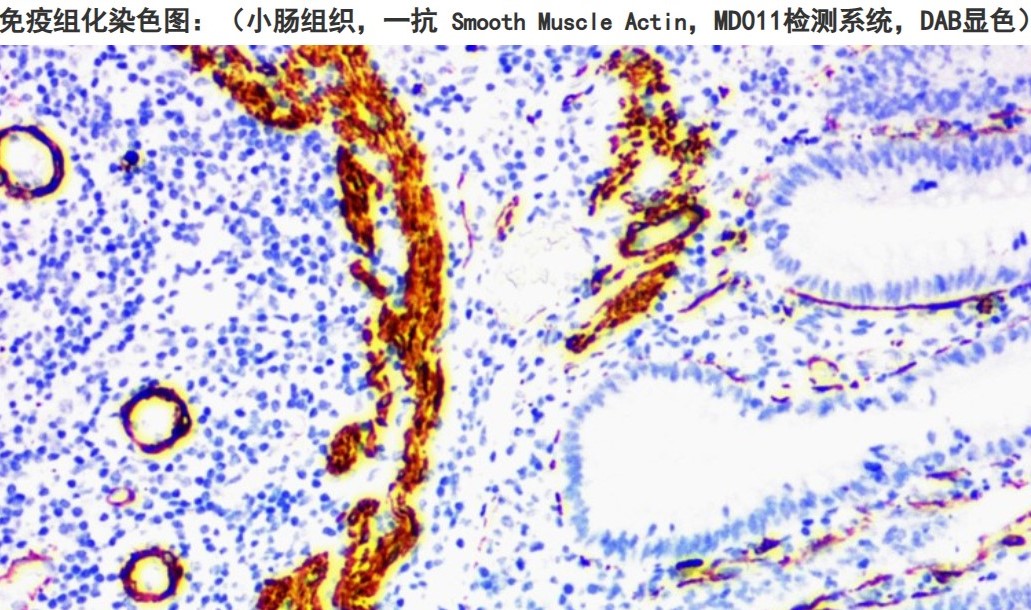 增强型HRP标记羊抗小鼠/兔聚合物二抗（免疫组化二抗）