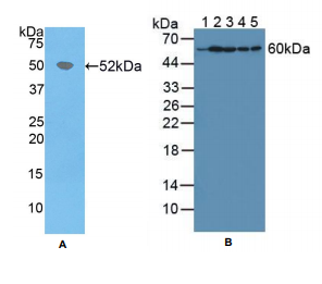 人次黄嘌呤磷酸核糖基转移酶1(HPRT1)多克隆抗体