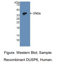 人双特异性磷酸酶6(DUSP6)多克隆抗体