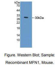 https://msimg.bioon.com/bionline/goods-no-pic.png