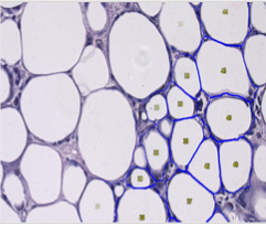 德国Wimasis 脂肪细胞图像分析30007