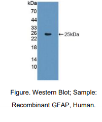 人神经胶质纤维酸性蛋白(GFAP)多克隆抗体