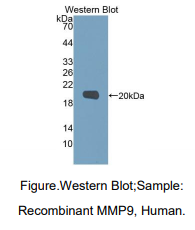 人基质金属蛋白酶9(MMP9)多克隆抗体